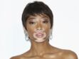 Découvrez le corps surprenant de la mannequin Winnie Harlow, atteinte de vitiligo, qui se dénude sur Instagram