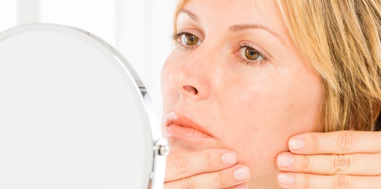acne adulte femme solution acne adulte femme solution