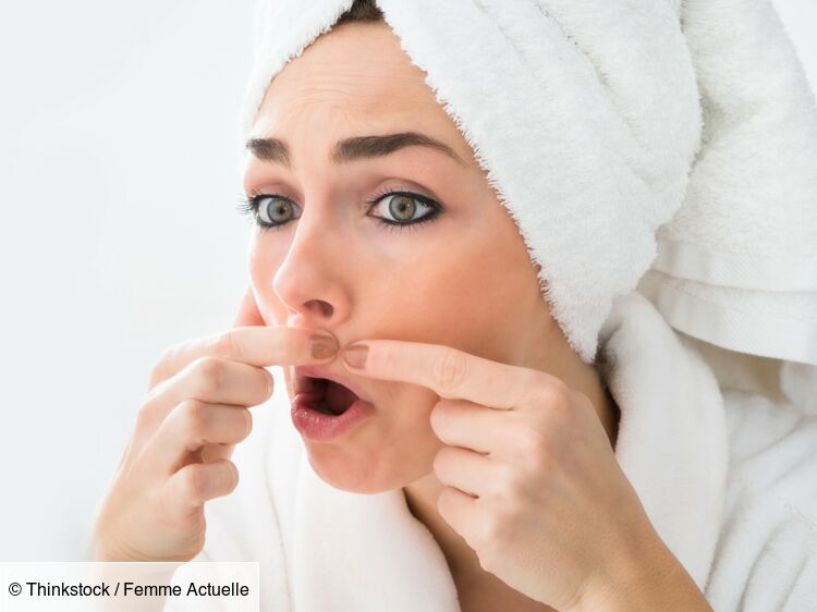 Problèmes De Peau Nos Remèdes Naturels Femme Actuelle Le Mag