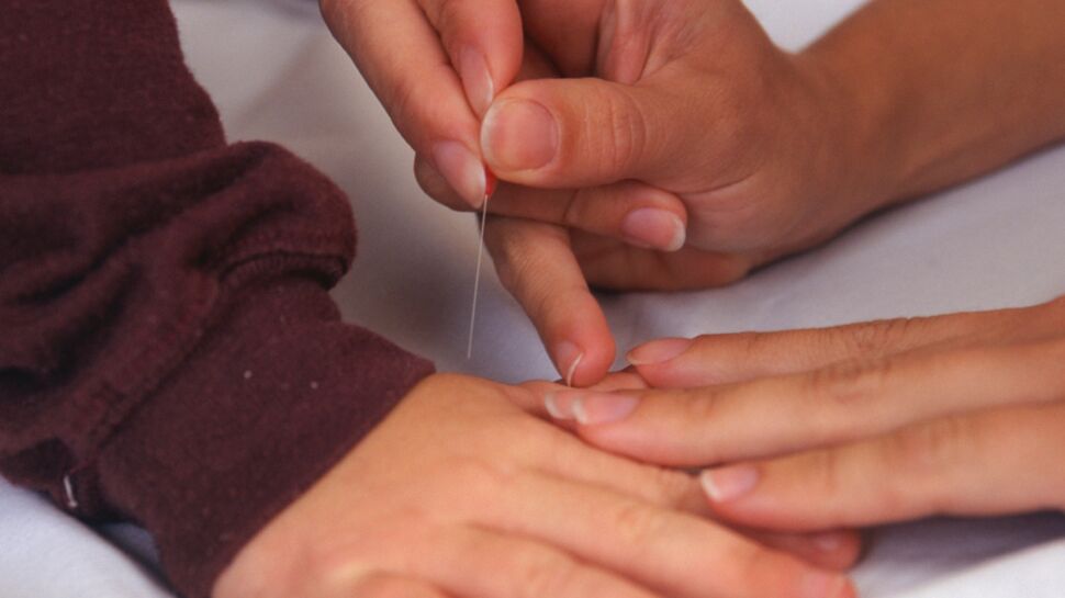 L’acupuncture pour soulager les douleurs chroniques chez l’enfant