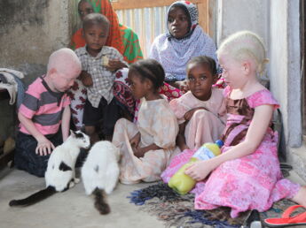 Un adolescent albinos mutilé, son cerveau disparu