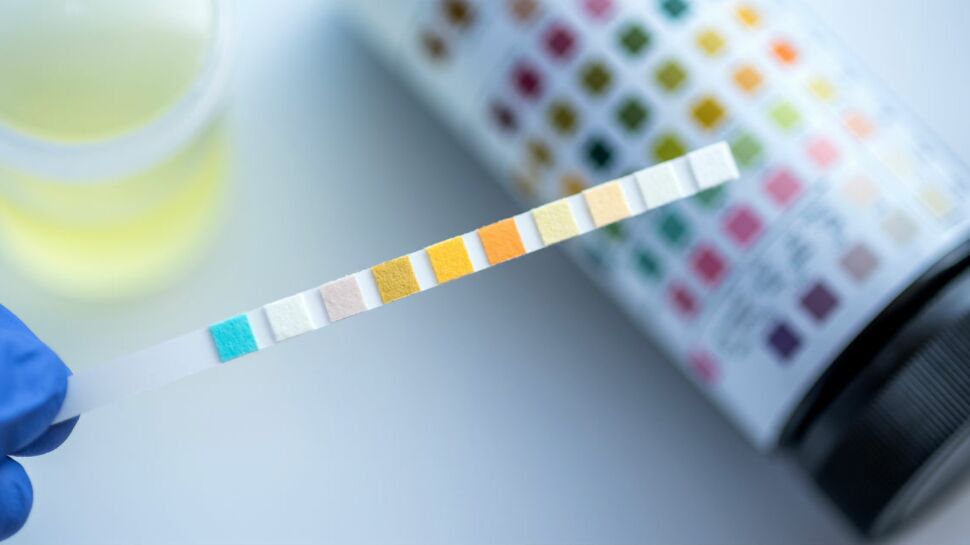 Alzheimer : un simple test d’urine pour détecter les risques