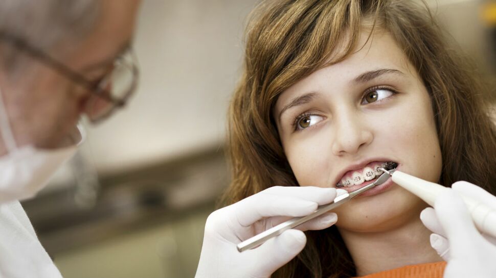 Appareils « faits maison » : la mise en garde des dentistes