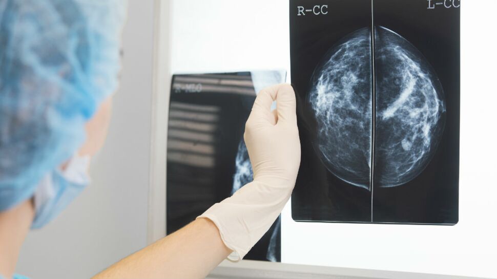 Cancer du sein : pourquoi le site officiel fait polémique