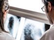 Cancer du poumon : les femmes plus touchées que les hommes et ce n’est pas seulement à cause du tabac