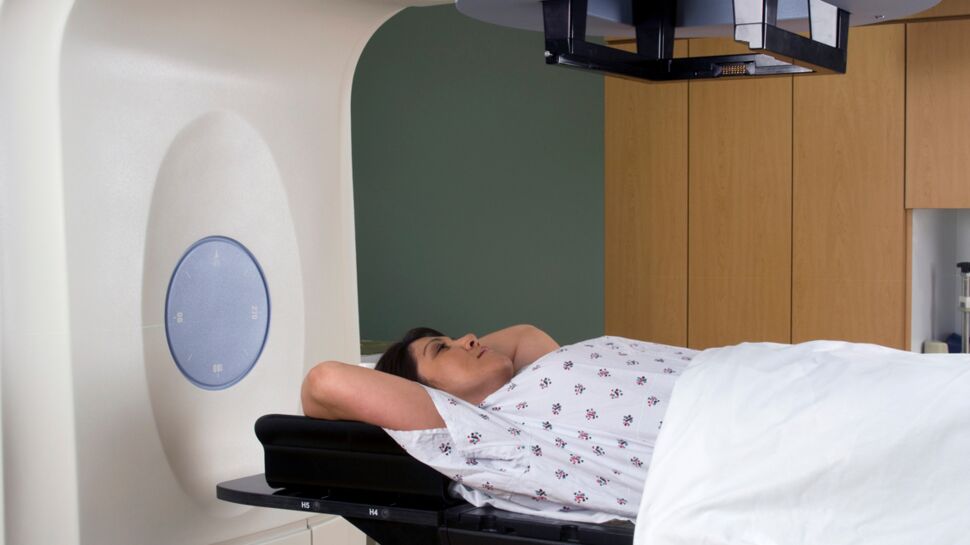 Cancer : bientôt un test pour prédire les séquelles après la radiothérapie ?
