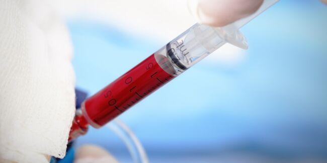 Un simple test sanguin capable de dépister très tôt les cancers les plus fréquents