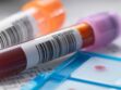Cancer : un test sanguin pour prédire la durée de vie des patients