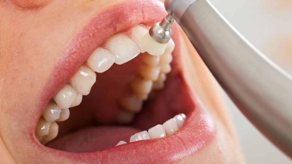 Caries : un nouveau traitement pour faire repousser l’émail des dents
