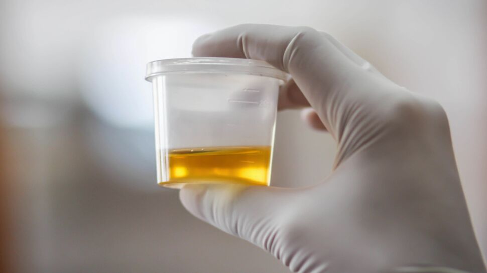 Détecter certains cancers avec un test d'urine bientôt possible ?