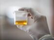 Détecter certains cancers avec un test d'urine bientôt possible ?
