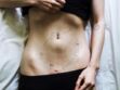 Endométriose : une photographe affiche son ventre pour sensibiliser à la maladie