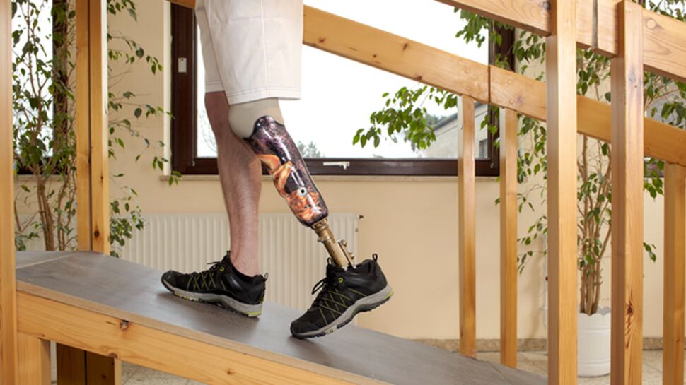 Handicap International va bientôt fabriquer des prothèses grâce à l'impression 3D