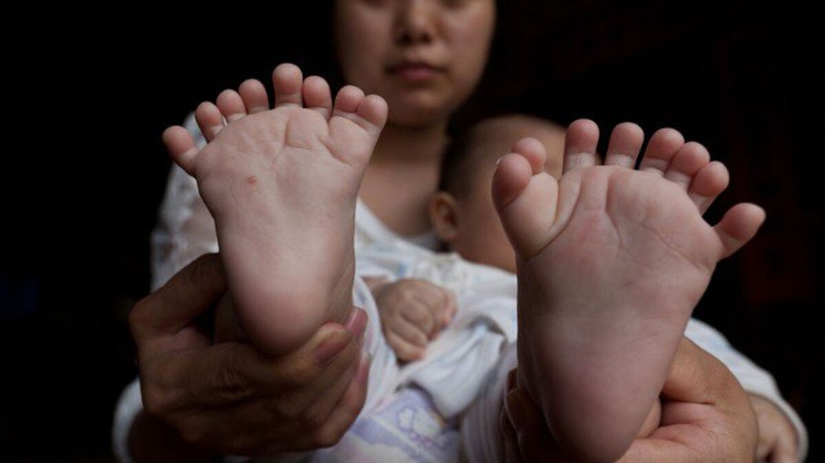 Insolite : un bébé chinois est né avec 31 doigts et orteils : Femme  Actuelle Le MAG