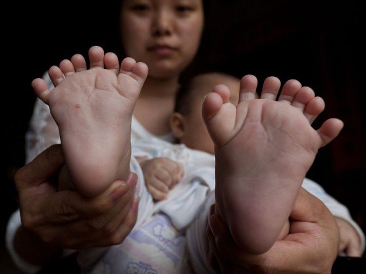 Insolite Un Bebe Chinois Est Ne Avec 31 Doigts Et Orteils Femme Actuelle Le Mag