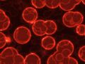 Cancer du sang : des lymphocytes T reprogrammés comme traitement