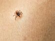 Maladie de Lyme : une première plainte pour tromperie aggravée