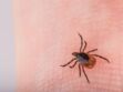 Maladie de Lyme : attention aux autotests vendus en pharmacie