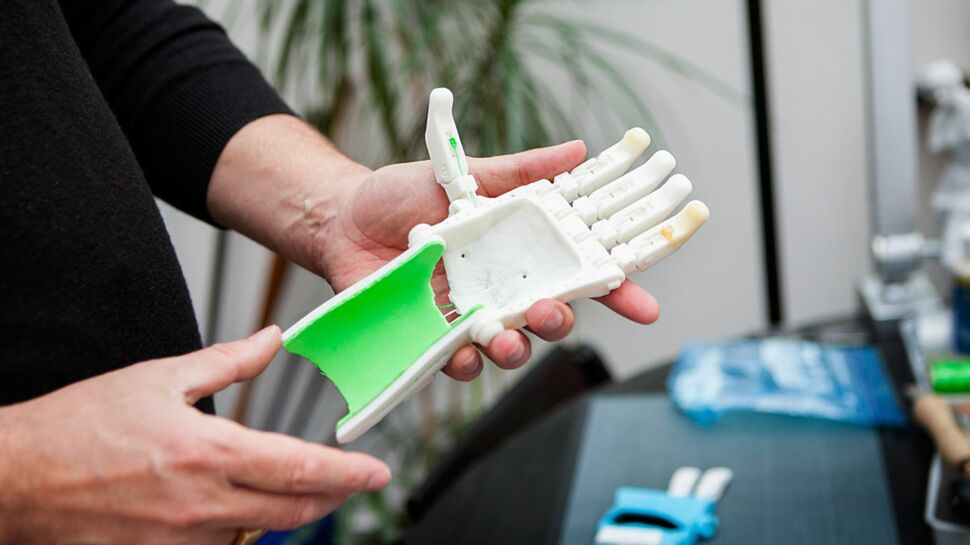Maxence : le premier enfant français à recevoir une prothèse imprimée en 3D