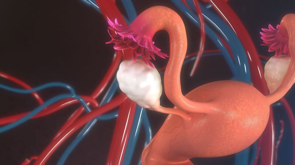 Ménopause : bientôt des ovaires artificiels pour atténuer les symptômes ?