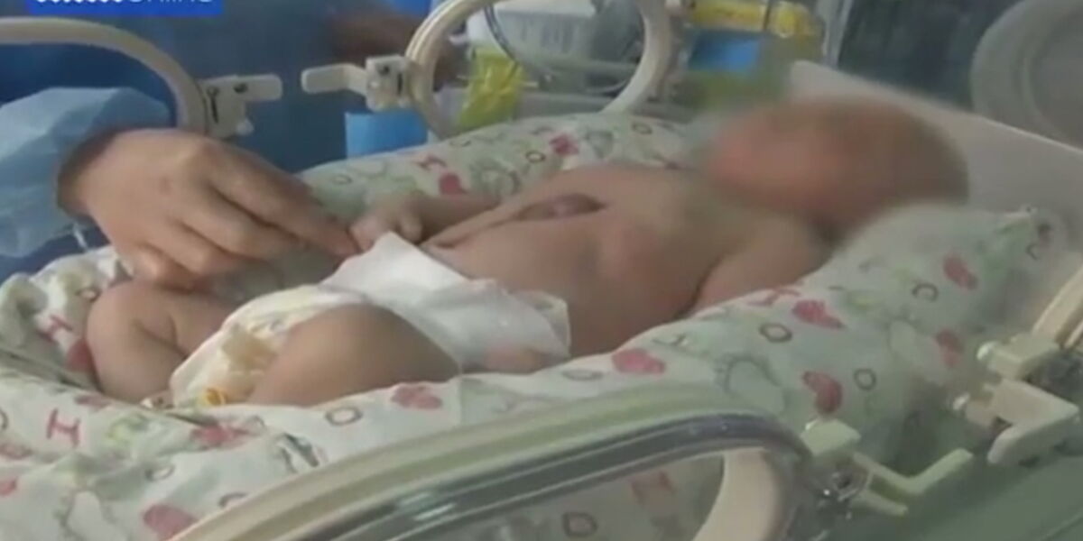 Syndrome De Cantrell Un Bebe Nait Avec Le Cœur Hors De La Poitrine Femme Actuelle Le Mag Syndrome De Cantrell Un Bebe Nait Avec Le Cœur Hors De La Poitrine Femme Actuelle Le Mag