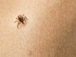 Maladie de Lyme : les bons gestes pour éviter de se faire piquer par des tiques