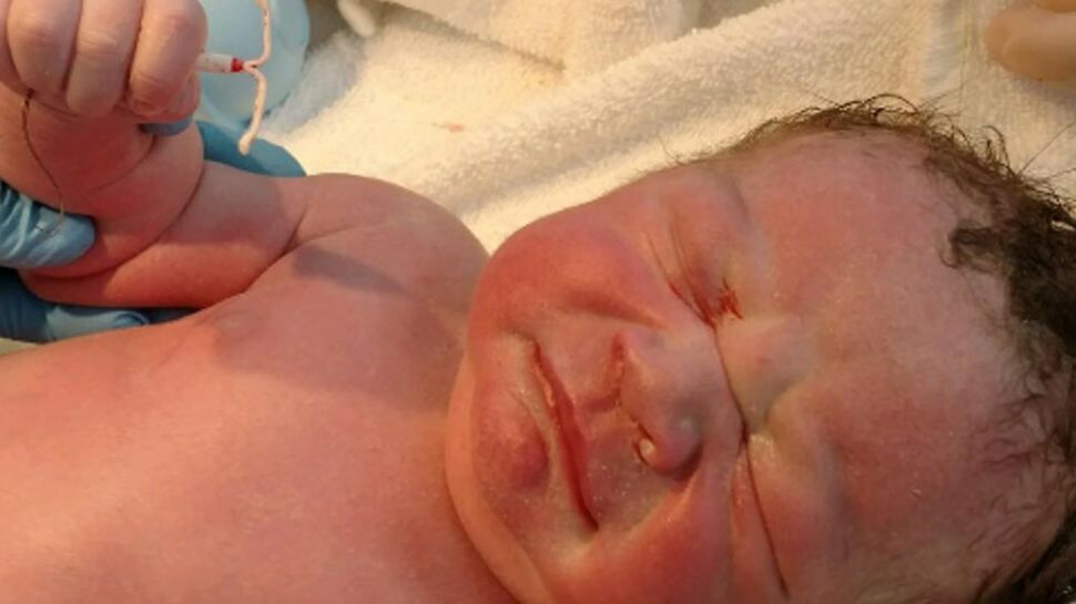 Un bébé pose avec le stérilet qui aurait dû l’empêcher de voir le jour
