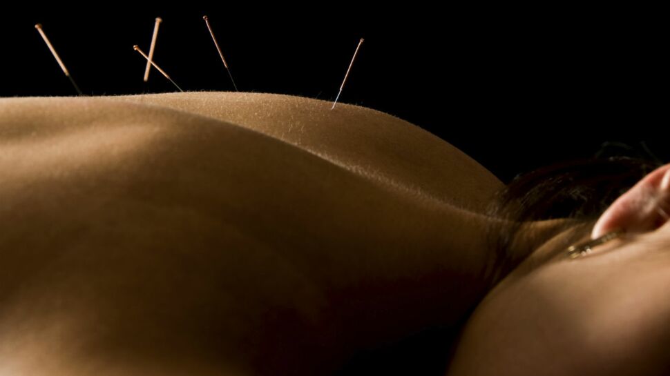 Une nouvelle indication pour l’acupuncture : la bronchite chronique