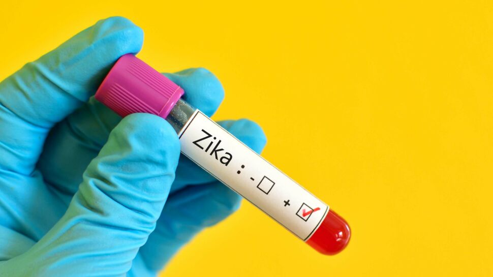 Zika : un cas de microcéphalie en Espagne