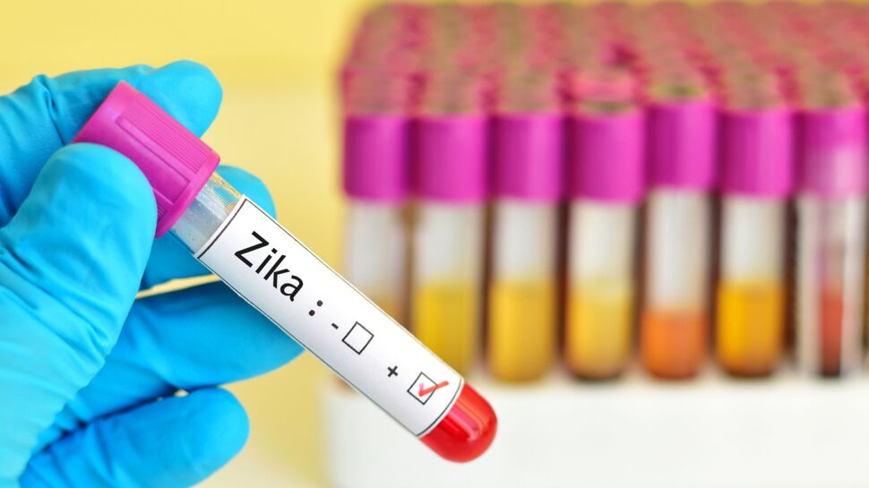 Zika : un premier cas de microcéphalie suspecté en France