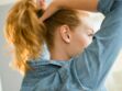 Calvitie : comment freiner la chute des cheveux ?