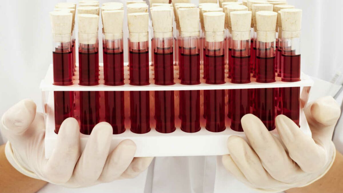 Analyse de sang : comprendre ses résultats : Femme Actuelle Le MAG