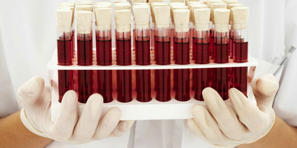 Analyse de sang : comprendre ses résultats