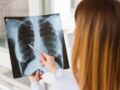 Cancer du poumon : les symptômes qui doivent vous pousser à consulter