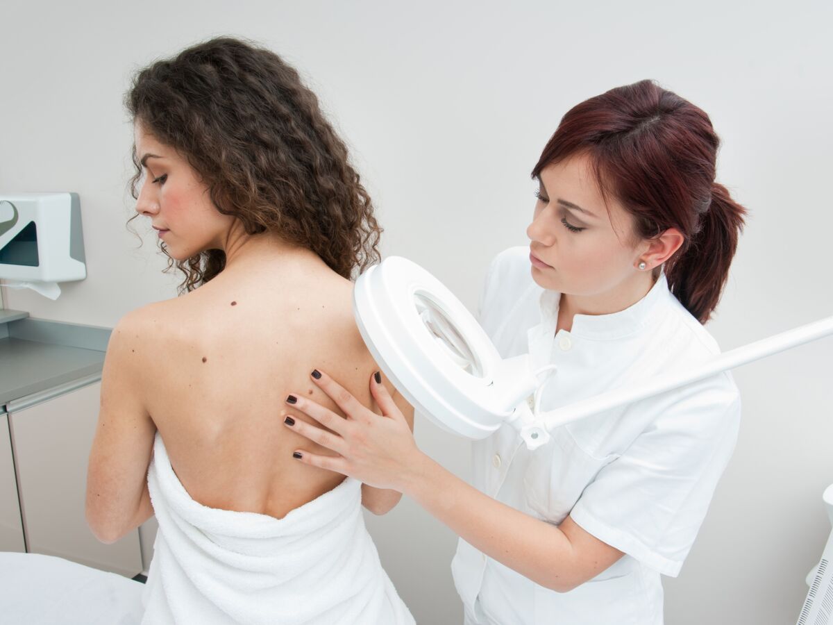 Cancers de la peau : les signes qui doivent vous alerter : Femme ...