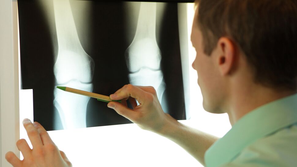 Comment améliorer la prise en charge de l’ostéoporose ?