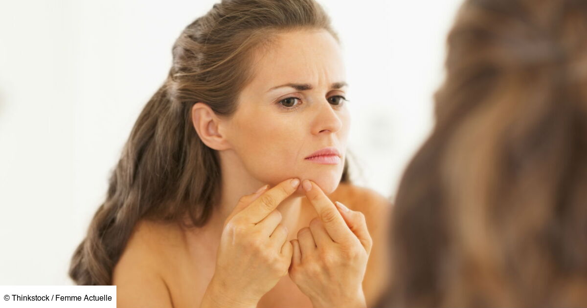 Comment avoir moins de boutons ? Les 5 commandements des dermatologues