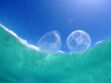 Comment soigner une piqûre de méduse ?