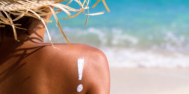 Les Coup De Soleil Se Transforme En Bronzage Vrai / Faux : 20 idées reçues sur les coups de soleil : Femme Actuelle