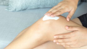 Taches De Naissance 4 Choses A Savoir Femme Actuelle Le Mag