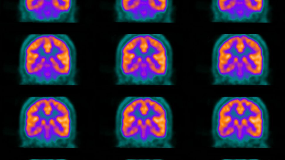 Scanner, IRM, échographie... Que faut-il savoir sur les principaux examens d'imagerie médicale ?