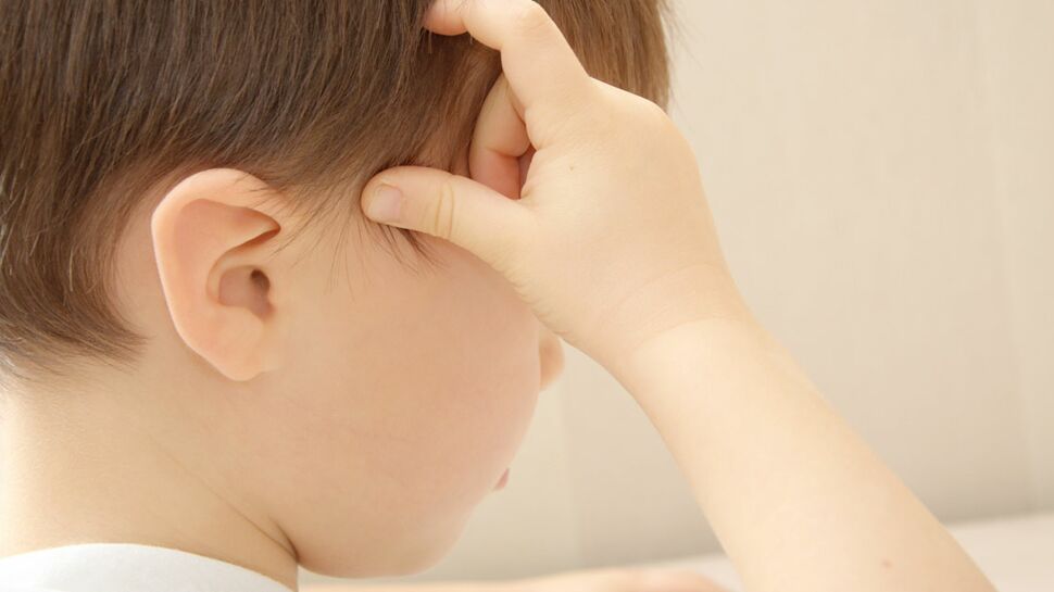 Impétigo : une maladie de peau fréquente chez les enfants