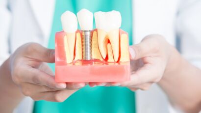 Prothèse dentaire : quelle différence entre les différentes prothèses et  laquelle est faite pour vous ? : Femme Actuelle Le MAG