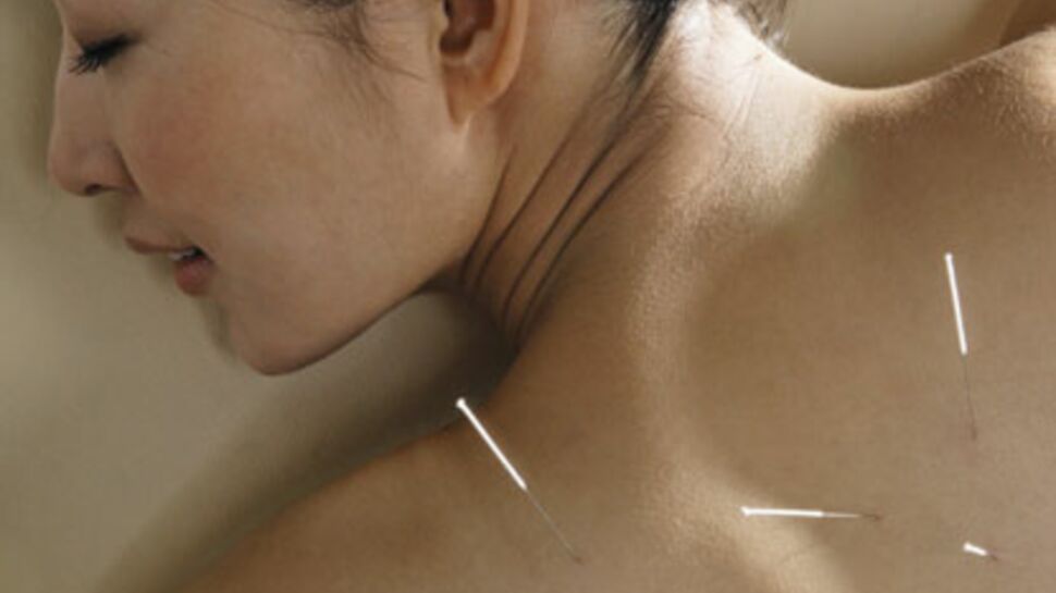 Cancer : l'acupuncture efficace ?