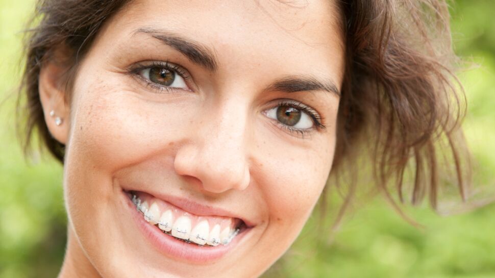 Orthodontie : pour les adultes aussi