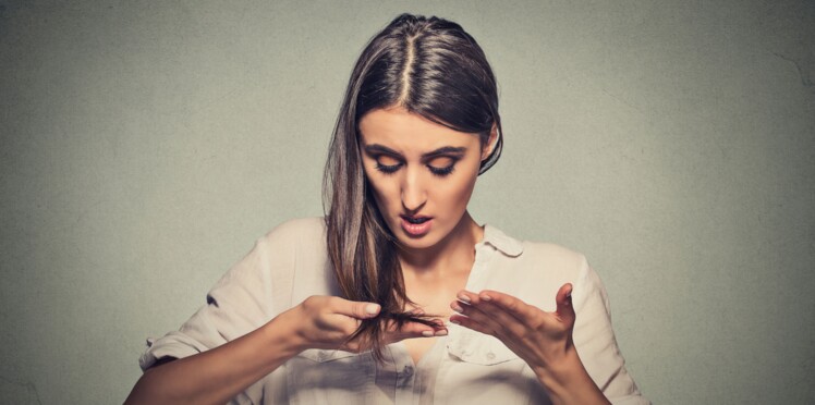 Pelade Causes Symptômes Et Traitements Femme Actuelle