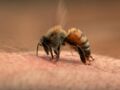 Piqûres d'insectes : attention aux dangers !