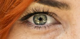 Le chalazion, une inflammation de la paupière à ne pas prendre à la ...