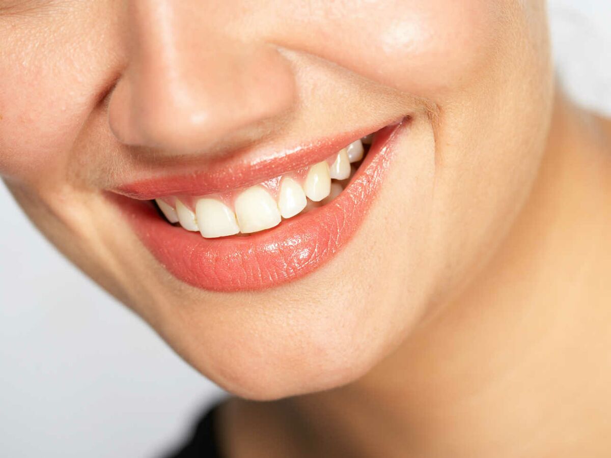 Solutions pour remplacer une dent manquante (dent provisoire
