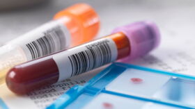 Hematemese Vomir Du Sang Qu Est Ce Que Ca Cache Femme Actuelle Le Mag